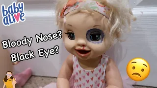 Baby Alive Emma Gets a Black Eye & Bloody Nose?! 😳 | Kelli Maple