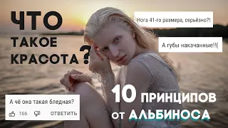 Почему такая бледная? – альбинос Сандра Рич о похищении, хейтерах в TikTok и публикациях в Vogue