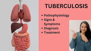 Tuberculosis (TB) || Signs &Symptoms || Pathophysiology || Diagnosis || Treatment