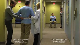 DBS Parkinson’s Off/On Demo Walking