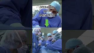 OPERATION WITH AND WITHOUT ANESTHESIA - Mr Bean Videos