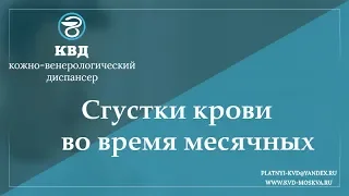 750  Сгустки крови во время месячных