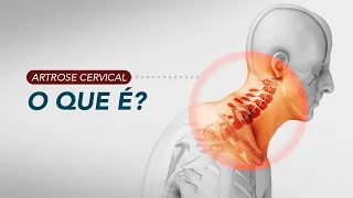 Artrose da coluna cervical  - O que é e como fazemos o diagnóstico