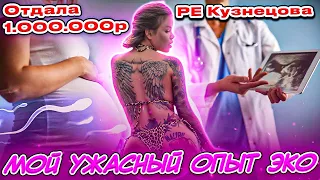 МОЙ УЖАСНЫЙ ОПЫТ ЭКО 🔬 😱😱😱 #эко