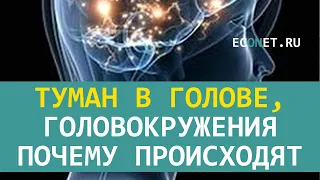 Туман в голове, головокружение, почему происходит | ECONET.RU