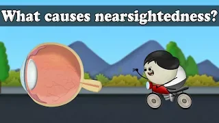 Myopia - What causes nearsightedness? | #aumsum #kids #science #education #children