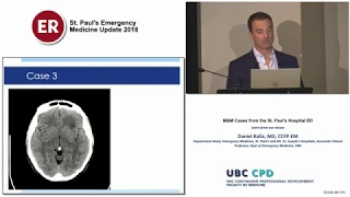 M&M Cases from the St. Paul’s Hospital ED (St Paul's EM Update 2018)