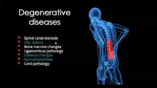 Spine X rays  Jan 2013   Dr Mamdouh Mahfouz In Arabic 720p