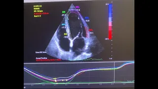 How to do strain echocardiogram ❤️✨