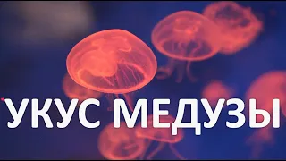 УКУС МЕДУЗЫ: Экстренная медицинская и Домедицинская помощь. Мифы, опасные заблуждения, частые ошибки