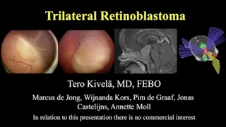 Retinoblastoma: Trilateral Retinoblastoma - Dr. Tero Kivela