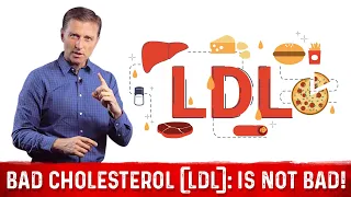 What is LDL Cholesterol? – Dr.Berg on LDL Bad Cholesterol (Part 4)