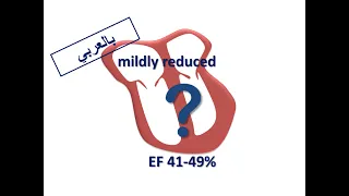 ESC Guidelines: Managing HFmrEF (Arabic Version)