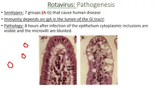 Viral Diarrheas