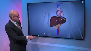 Stage IV Pancreatic Cancer