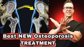 BEST Bone Health & Osteoporosis Treatment [Remedies, Diet & Vitamins]