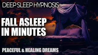 Hypnosis To Improve Sleep | Guided Sleep Meditation To Reduce Anxiety and Stop Overthinking