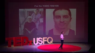 Lo que Gané al perder 1/3 de mi Cráneo  | Esteban Santamaría | TEDxUSFQ