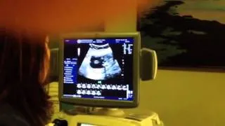 Princess ultrasound 3