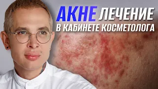 АКНЕ ЛЕЧЕНИЕ в кабинете косметолога | Роаккутан Сотрет опасность #акне #роаккутан #сотрет