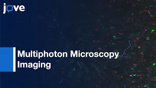 Multiphoton Microscopy Imaging of Immune Cells of Liver | Protocol Preview