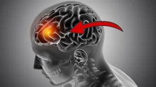 9 Symptome eines Gehirntumors, die du kennen SOLLTEST ⚡️