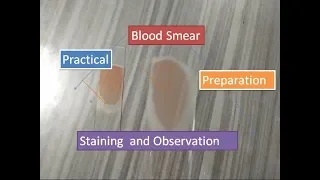 Blood Smear preparation, staining and observation