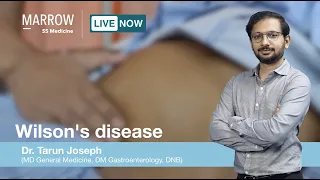 Wilson's disease | Dr. Tarun Joseph | Hepatology | Marrow SS Medicine is now live