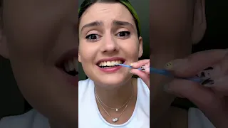 ¡Atención! APRENDE a ponerte los brackets en casa fácilmente (Si quieres DESTROZAR TUS DIENTES)