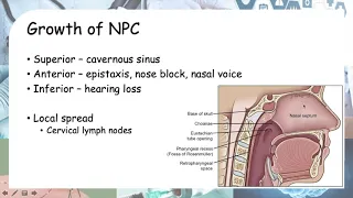 Nasopharyngeal cancer