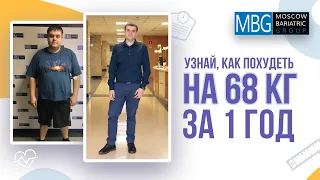 Минус 68 кг за год | Отзыв клиента после рукавной гастропластики