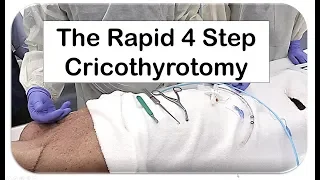 The Rapid 4 Step Cricothyrotomy Technique--Version 2