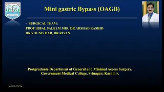 One Anastomosis Gastric Bypass (OAGB)