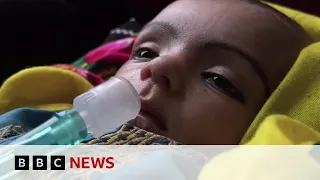 Children in Afghanistan dying from preventable diseases, says charity - BBC News