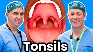 Should You Get Your Tonsils Taken Out?