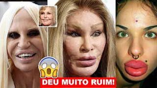 CIRURGIAS PLÁSTICAS que deram MUITO errado !!!! Antes e Depois de FAMOSOS.