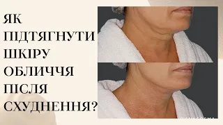 ЯК ПІДТЯГНУТИ ШКІРУ ОБЛИЧЧЯ ПІСЛЯ СХУДНЕННЯ ⁉️