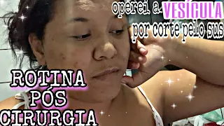 VLOG: ROTINA DO MEU DIA PÓS CIRURGIA | OPEREI A VESÍCULA POR CORTE | COMO ESTÁ MINHA RECUPERAÇÃO