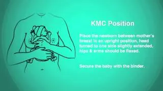 Kangaroo Mother Care (KMC)