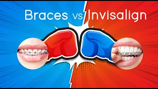 Battle of the Brands: INVISALIGN VS BRACES