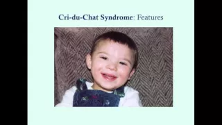 Cri du Chat - CRASH! Medical Review Series