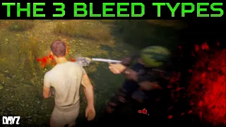 New Bleed Indicators, Blood Pressure Stat & 3 Bleeds in DayZ