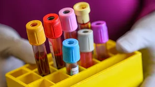 Doing More with Less: The Advantages of Optimizing Blood Collection Volumes for Laboratory Testing