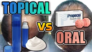 Topical Finasteride Vs. Oral Finasteride – Which Is Better And Why