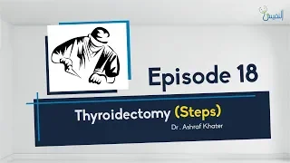 Thyroidectomy (Steps) 02 - Surgery - Prof. Ashraf Khater