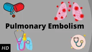 Pulmonary embolism, Causes, Signs and Symptoms, Diagnosis and Treatment.