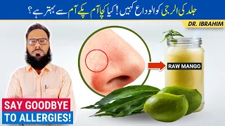 6 Incredible Benefits Of Raw Mango - Kairi Ke Fayde (NO MORE SKIN ALLERGIES!) Urdu/Hindi