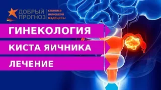 Эффективное лечение кисты яичника | Добрый прогноз