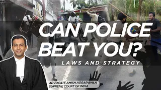 Can the police beat you? And what to do if they do: Laws and Strategy