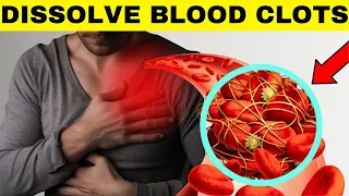 10 Everyday Foods That Naturally Dissolve Blood Clots